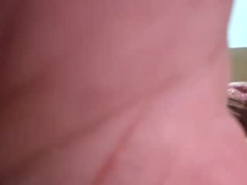 Anel794872