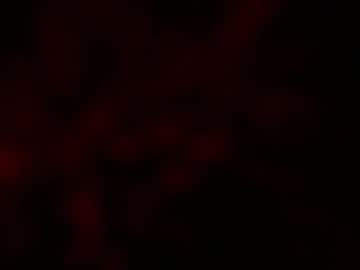 Kloelamaravilla18 Chaturbate stream image from December 07, 2025